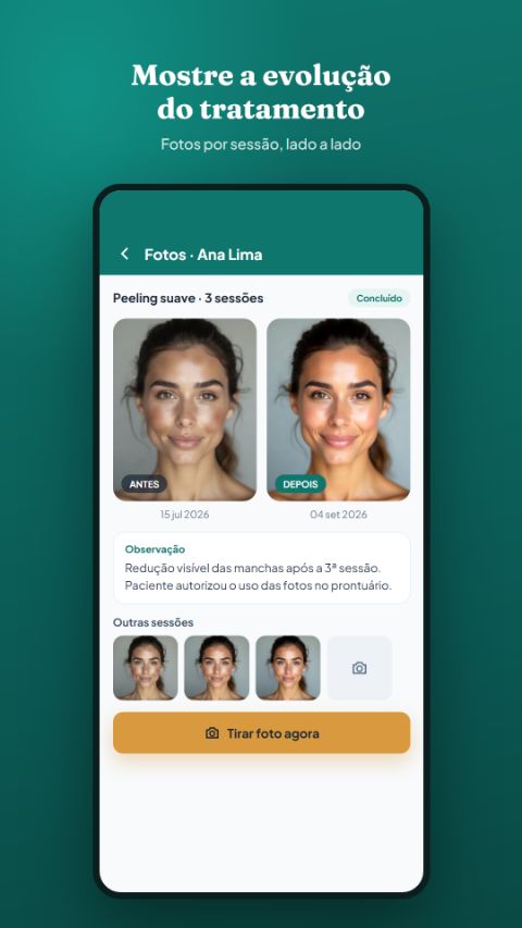 Fotos de antes e depois